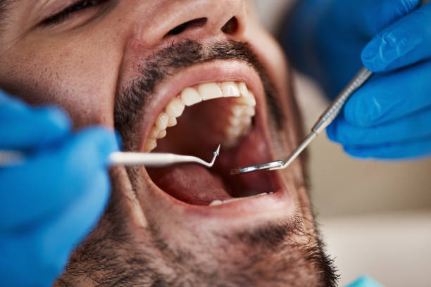 Best Tooth Infection Emergency Dentist  in Andale, KS